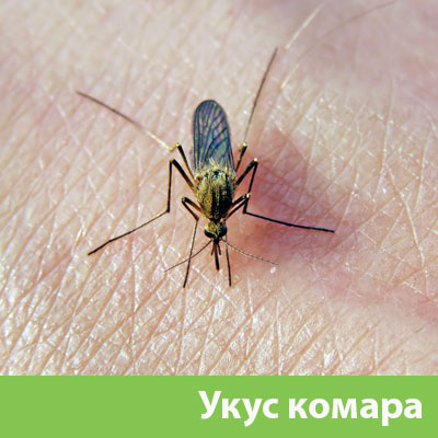 Укусы комаров в Новоуральске